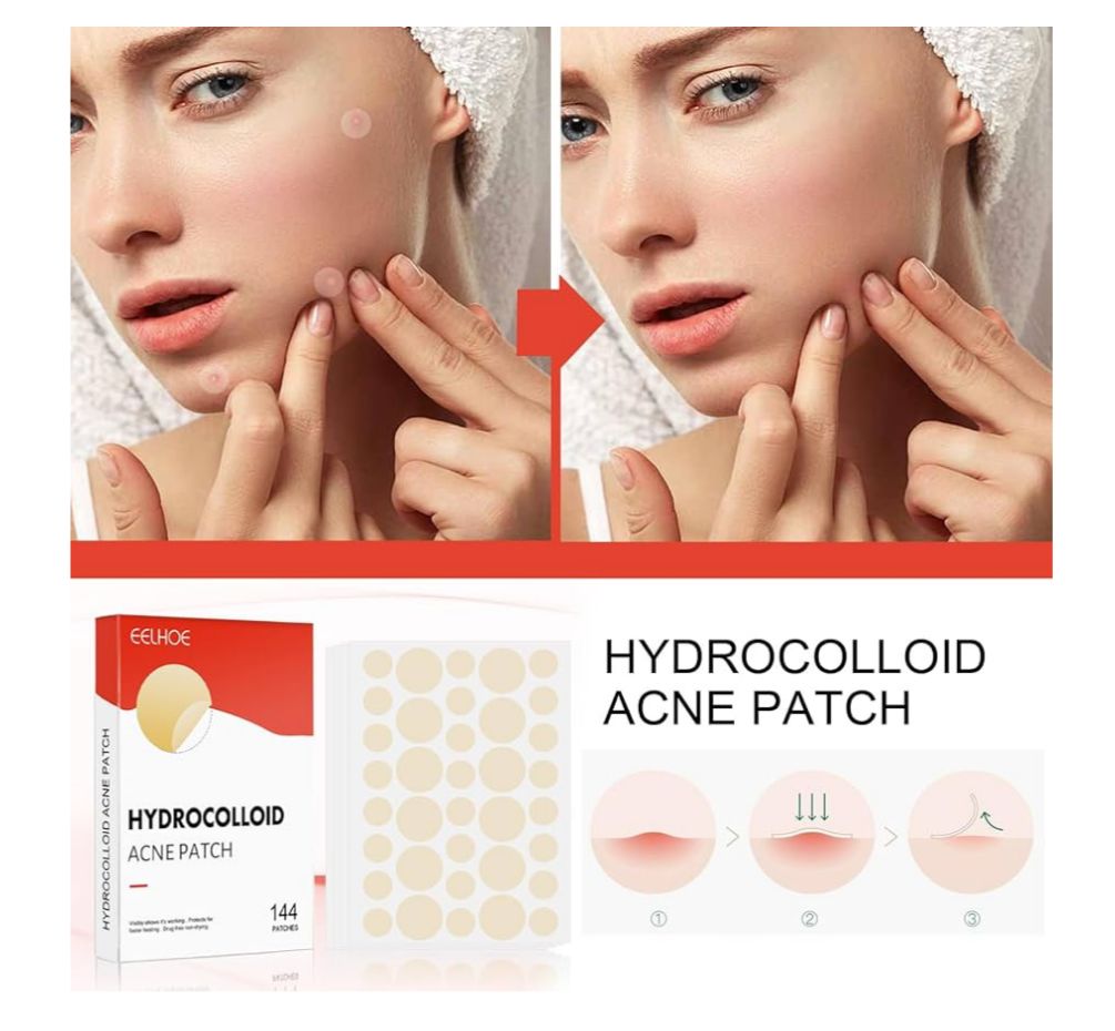 Parches Absorbentes Anti-Acné 24H (144 Unidades) – Tecnología Hidrocoloide Invisible
